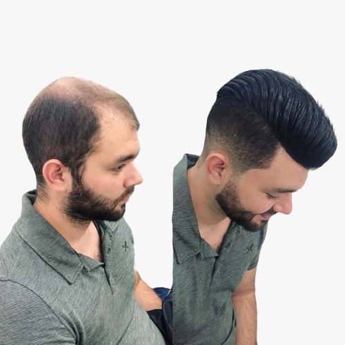 تركيب شعر دائم